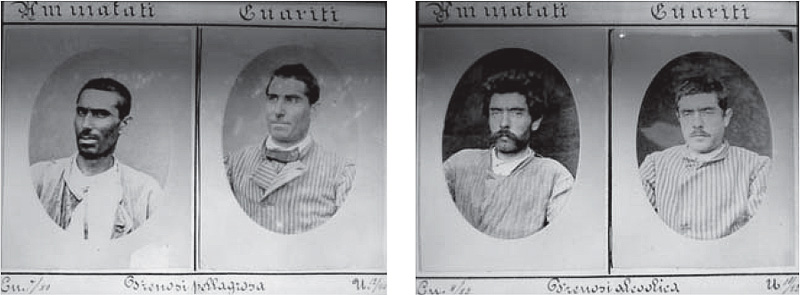 Fig. 2. Fotografie dell’archivio iconografico di San Servolo: all’immagine viene associata la diagnosi.